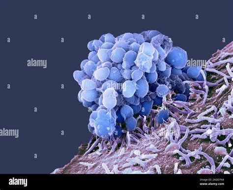 La Gonorrea Batteri Color Scanning Electron Microfotografia Sem Di Neisseria Gonorrhoeae