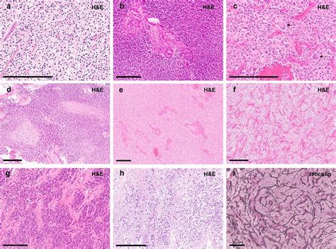 Typical Histological Features Of Tumors Within This Series Showing