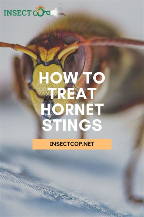 How To Treat Hornet Stings Insect Cop Hornet Sting Sting Hornet