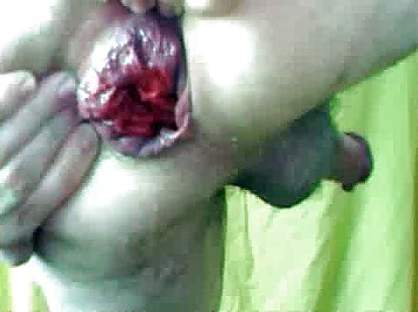 Prolapse Porn Pictures Xxx Photos Sex Images Pictoa