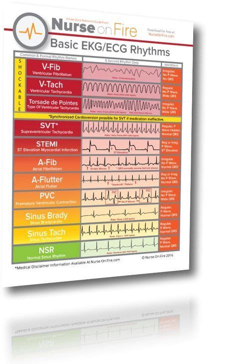 Nursing Ekg Cheat Sheet Great For New Nurses To Identify The Basic