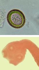 Final Lab Practical Review Parasitology Slides Quizlet