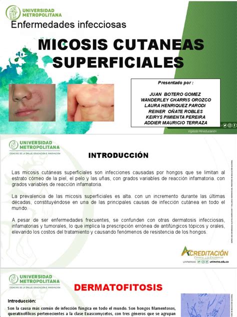 Micosis Cutáneas Superficiales Una Revisión De Las Dermatofitosis Pdf Candidiasis