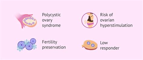 Indications of in vitro maturation (IVM)