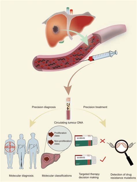 Prospects Of Ctdna In Precision Medicine For Hcc Ctdna Is Free Nucleic