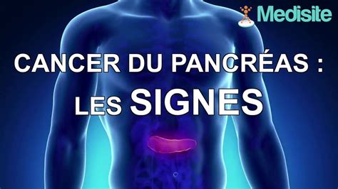 Cancer Du Pancréas Les Signes Vidéo Dailymotion