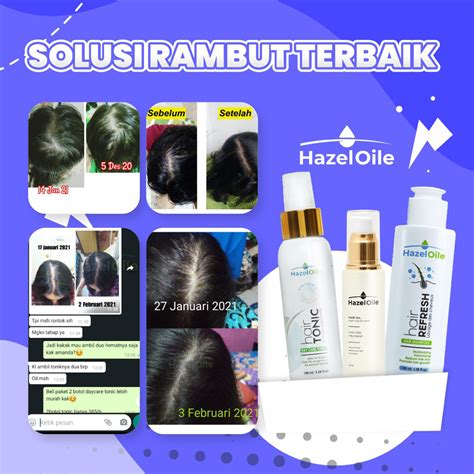 Jual BPOM HazelOile Rambut Rontok Treatment Hair Tonic Tonik Penumbuh