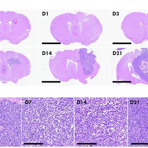 PDF Temporal And Spatial Modulation Of The Tumor And Systemic Immune