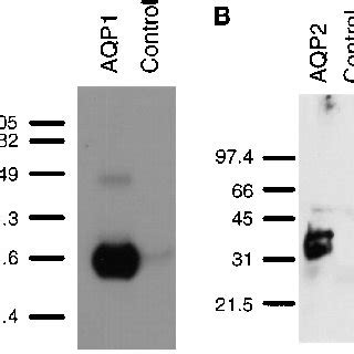 Detection Of Aquaporin Aqp Mrna By Rt Pcr In Rat Distal Colon A