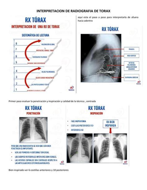 Interpretaci N De Radiograf A De T Rax Enfermer A Udocz