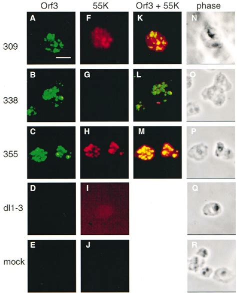 Double Label Immunofluorescence Analysis Of Nuclear Matrix From