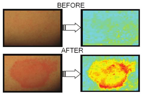 The before and after effect of methyl nicotinate. | Download Scientific ...