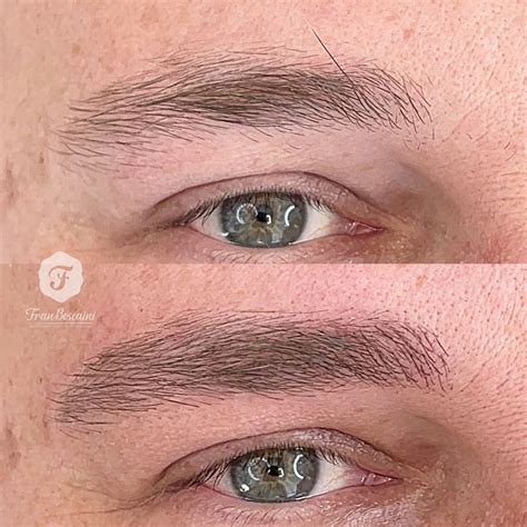 Micropigmenta O De Barba Microblading Fio A Fio T Cnica Nanoblading