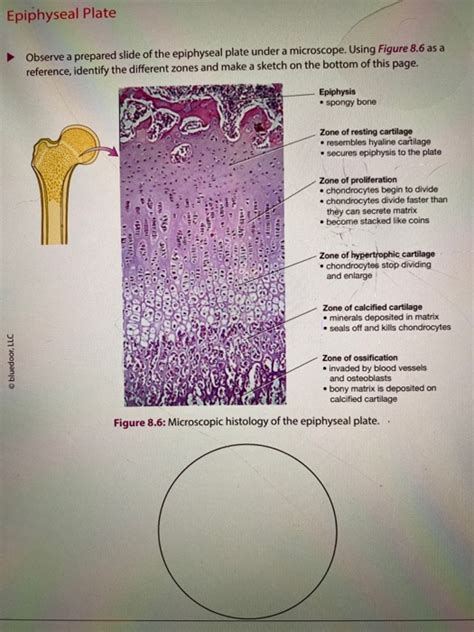 Epiphyseal Plate Observe a prepared slide of the | Chegg.com