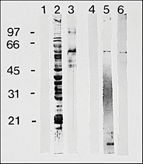 Anti Human Igg Gamma Chain Sp A Ml Sigma Aldrich Sls Ireland