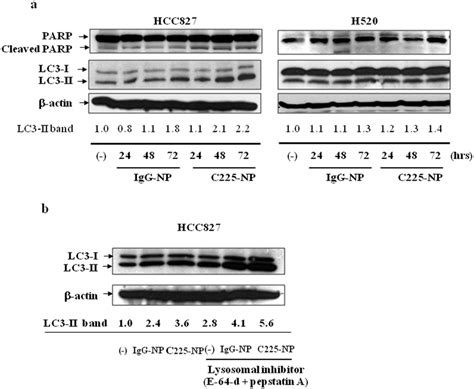 Analysis For Molecular Markers Of Autophagy And Apoptosis In