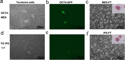 OCT4 Positive Pluripotent Cells Isolated From Teratomas Have Typical