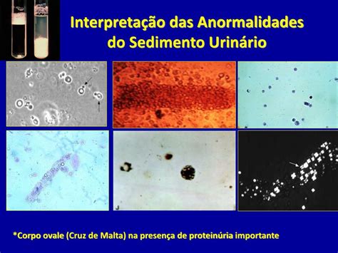 Ppt Diagn Stico E Estadiamento Da Doen A Renal Cr Nica Powerpoint