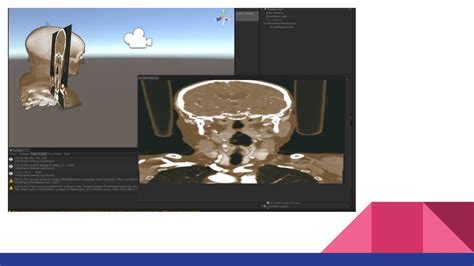 Volume Rendering In Unity3D Speaker Deck