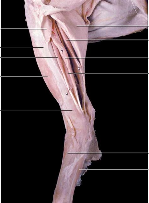 Cat Medial Shank Diagram Quizlet