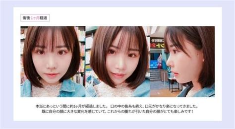 【300万で手にした第2の人生】深田えいみの整形前が全然違う！本人の「コンプレックスは直すもの」が素敵すぎる！ 芸能人のあの噂