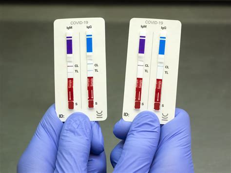 An Lisis De Infecciones Para Toxoplasma Igm Anticuerpos An Lisis