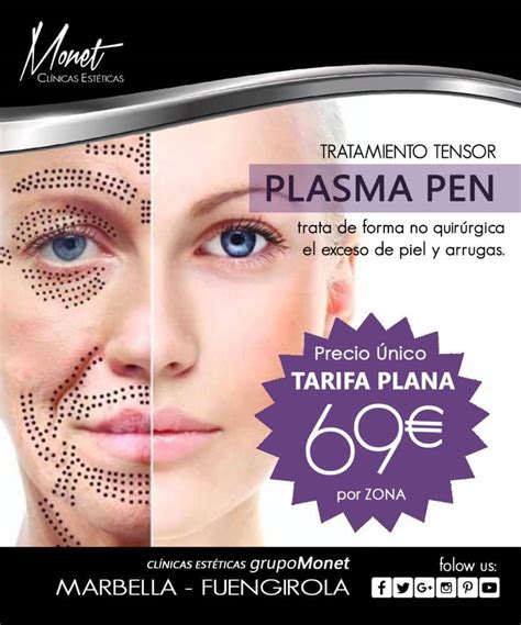 Plasma Pen Fibroplast Cl Nicas Est Ticas Monet En Marbella Y Fuengirola