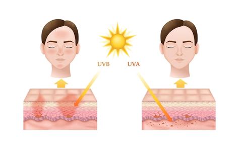 Premium Vector Realistic Infographics Showing How Uvb And Uva Sun