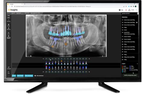 What S New In CS Imaging V8 0 20 Carestream Dental