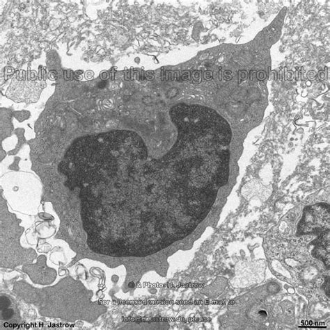 Monocytes Drjastrows Electron Microscopic Atlas