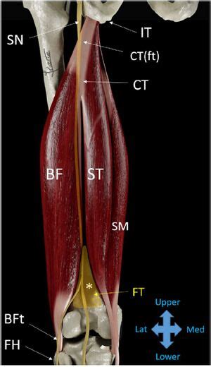 Proximal Hamstring Tendinopathy Wikism Sports Medicine Wiki