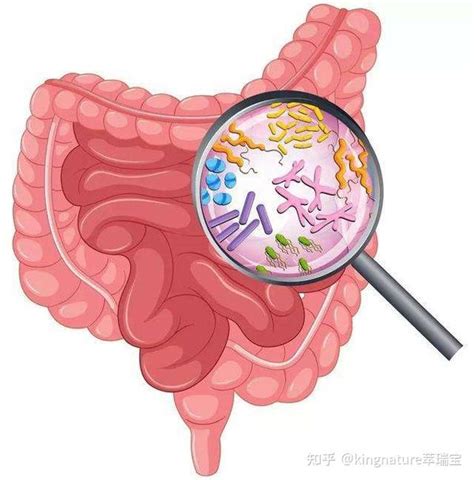 肠道健康是抵抗慢性疾病的基石 知乎