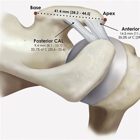 Coracoacromial Arch