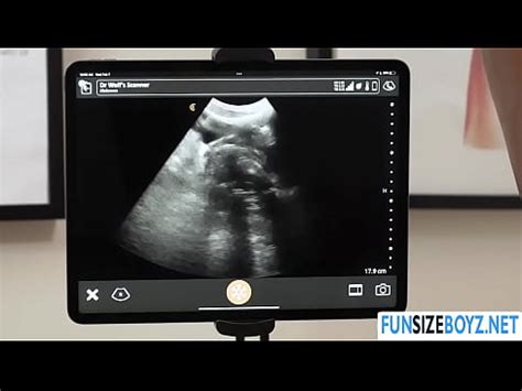 Le docteur Legrand Wolf baise à cru son patient Noah White XVIDEOS