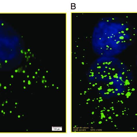 Localization Of Icmt In Ins Cells By Immunofluorescence Under