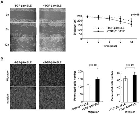 The TGF B1 Induced Migration And Invasion Abilities Of MCF 7 Cells Were