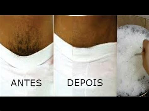 Pare De Depilar Use Bicarbonato De S Dio Para A Remover Pelos