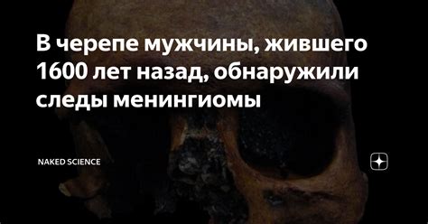 В черепе мужчины жившего 1600 лет назад обнаружили следы менингиомы