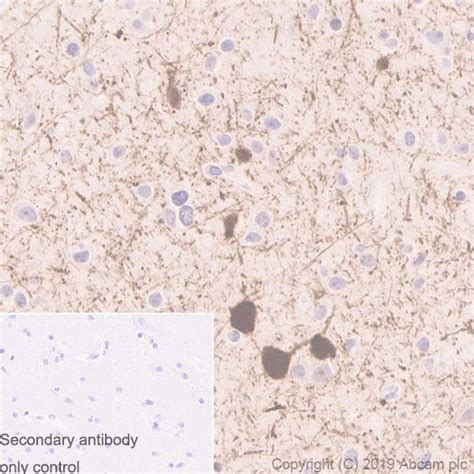 Anti Parvalbumin Antibody Epr Bsa And Azide Free Ab