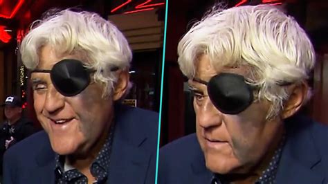 Jay Leno Shocks Fans With Eye Patch And Massive Face Bruise After Falling