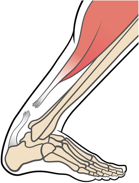 Mechanisms Of Achilles Tendon Rupture In National Basketball