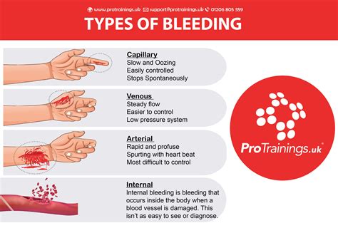 Internal Bleeding Symptoms Causes And Treatment