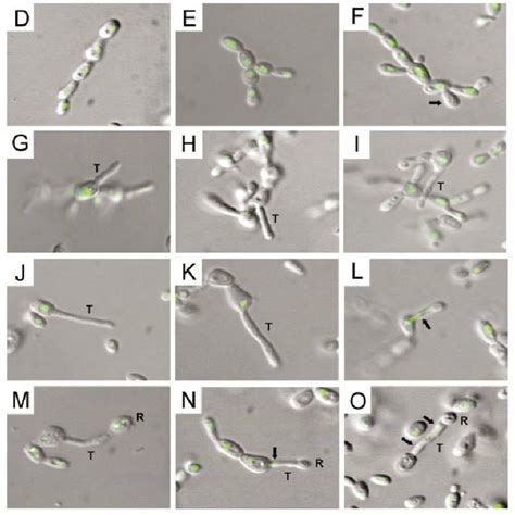 Chitin Distribution And Cell Morphologies Of Yeast Budding Cells A D