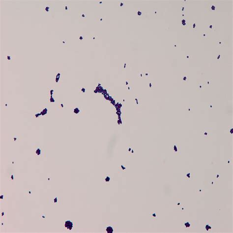 Gram Stain Film Of The Cerebrospinal Fluid Culture Growing