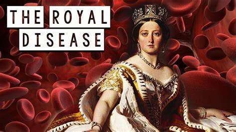 The Royal Disease How Queen Victoria Spread This Disease Across