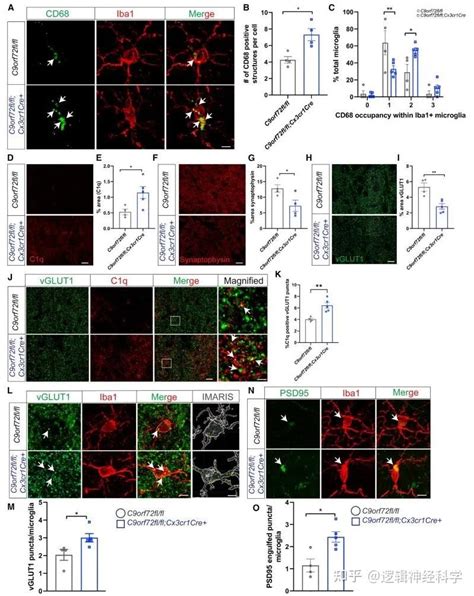 Neuron︱小胶质细胞c9orf72基因缺失促进突触丢失 学习记忆缺陷的新机制 知乎