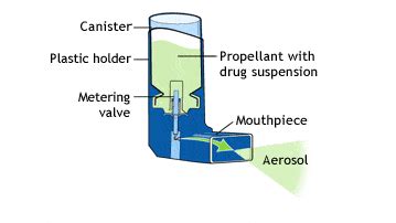 Metered Dose Inhaler | MBC Aerosol