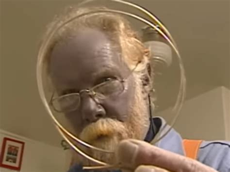 Man Turns Blue After Consuming Dietary Supplements