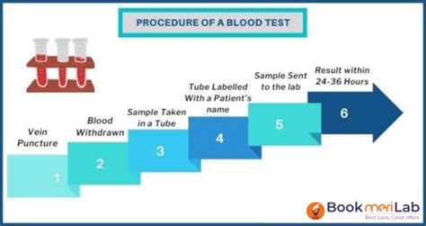 Anti TPO Test Price Purpose Results And Range 2025 Bookmerilab