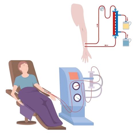 Dialysis Connections Over Royalty Free Licensable Stock Vectors